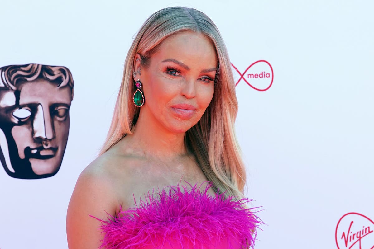 Katie Piper Fitted With Artificial Eye