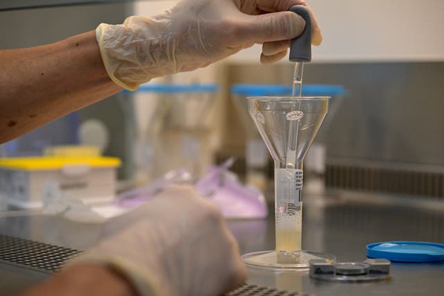 <p>File: A laboratory assistant homogenises sperm in order to produce a spermogram at the Centre for the Study and Conservation of Human Eggs and Sperm</p>