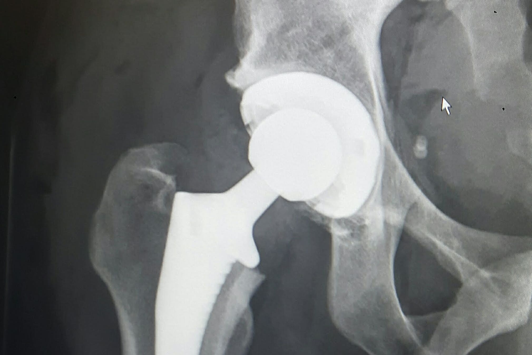 The medical equipment firm makes knee and hip replacements (Stuart Johnson/University of Bristol/PA)