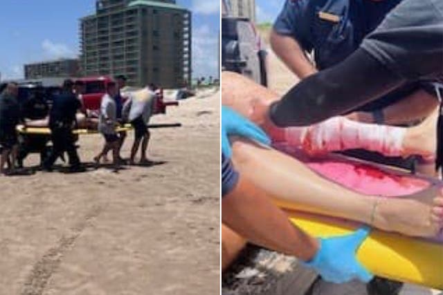 <p>A shark attack victim being helped by US Border Patrol on South Padre Beach on the Fourth of July </p>
