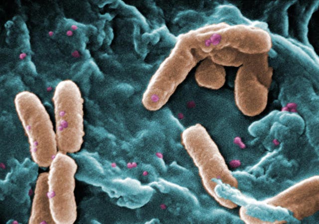 <p>Bacterias ‘Pseudomonas’</p>