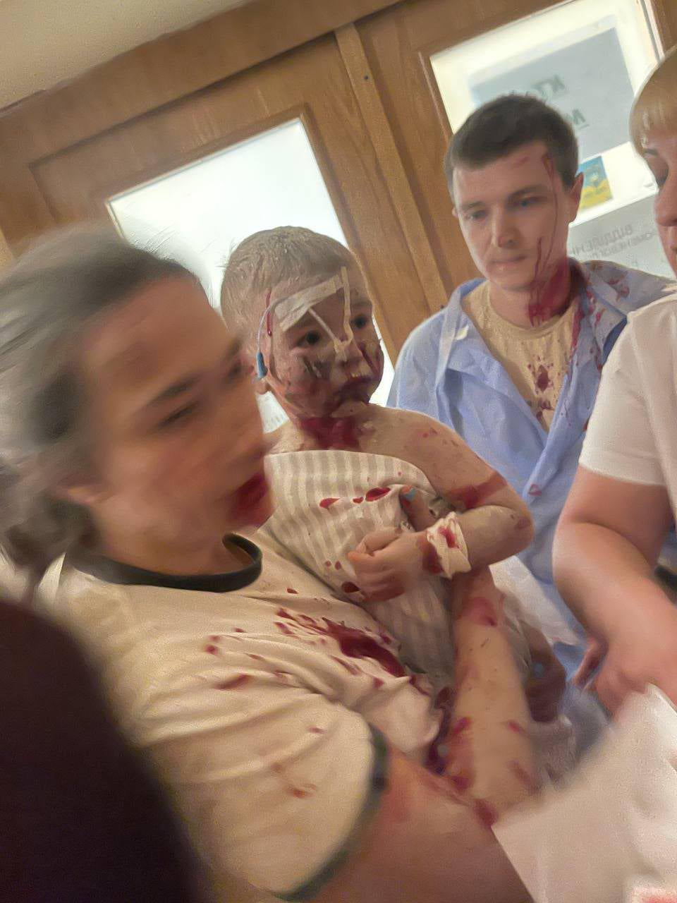 An adviser to Volodymyr Zelensky shared this picture of a child caught up in the horror