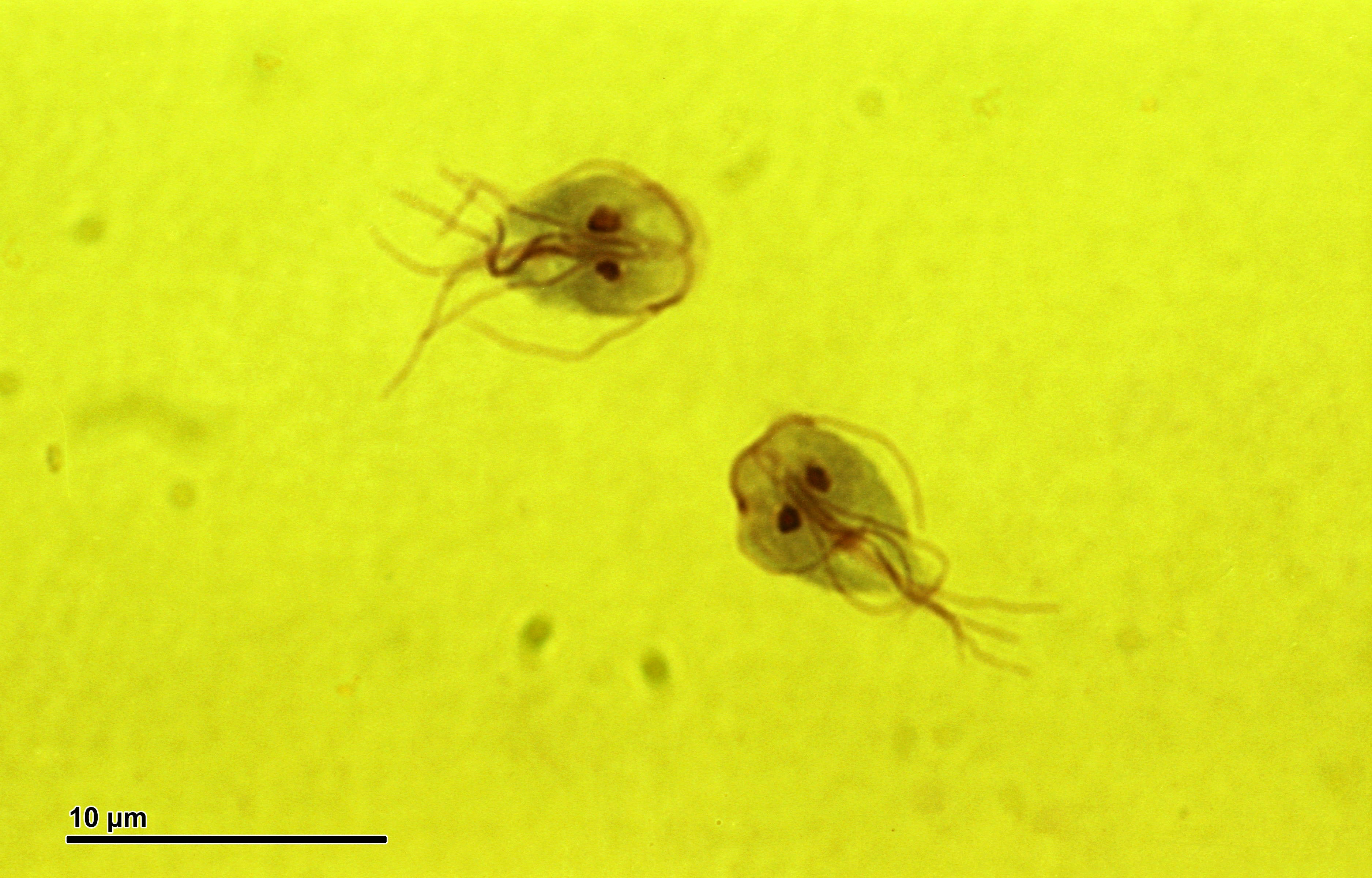 Giardia parasites