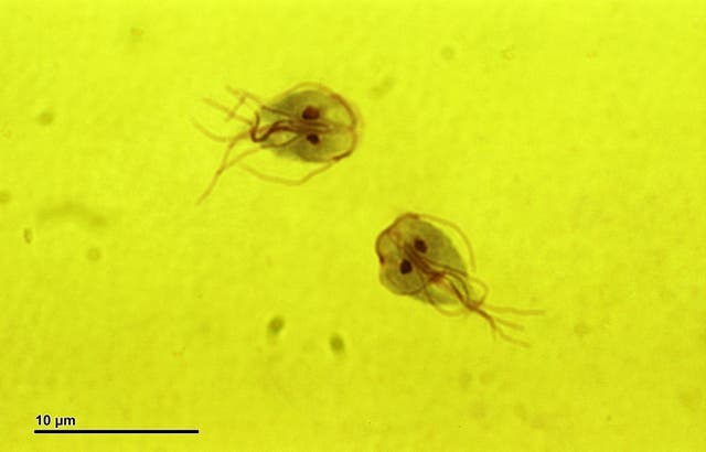<p>Giardia parasites </p>