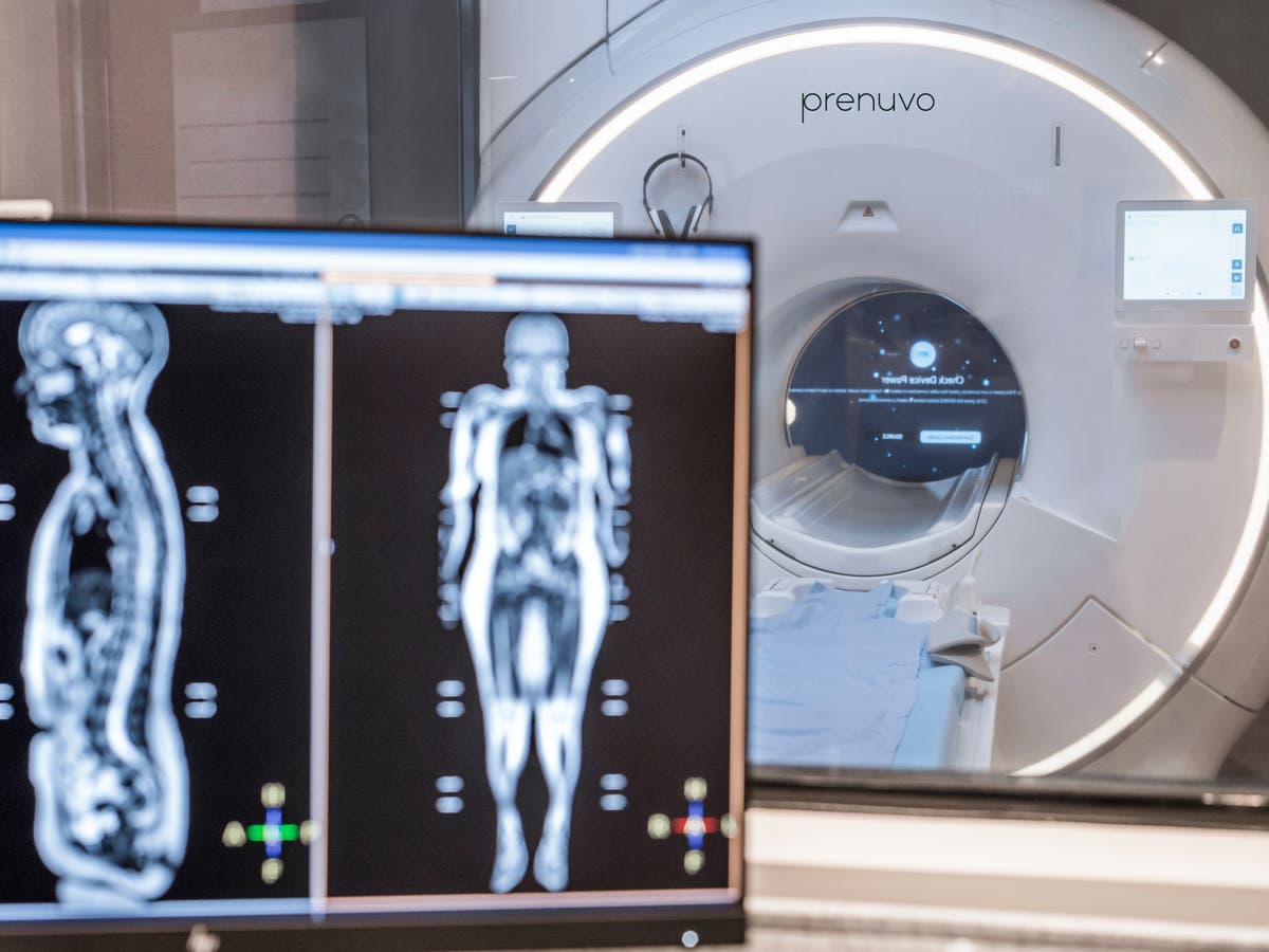 Celebrities are getting $2,000 MRI scans to learn about their health. Should you?