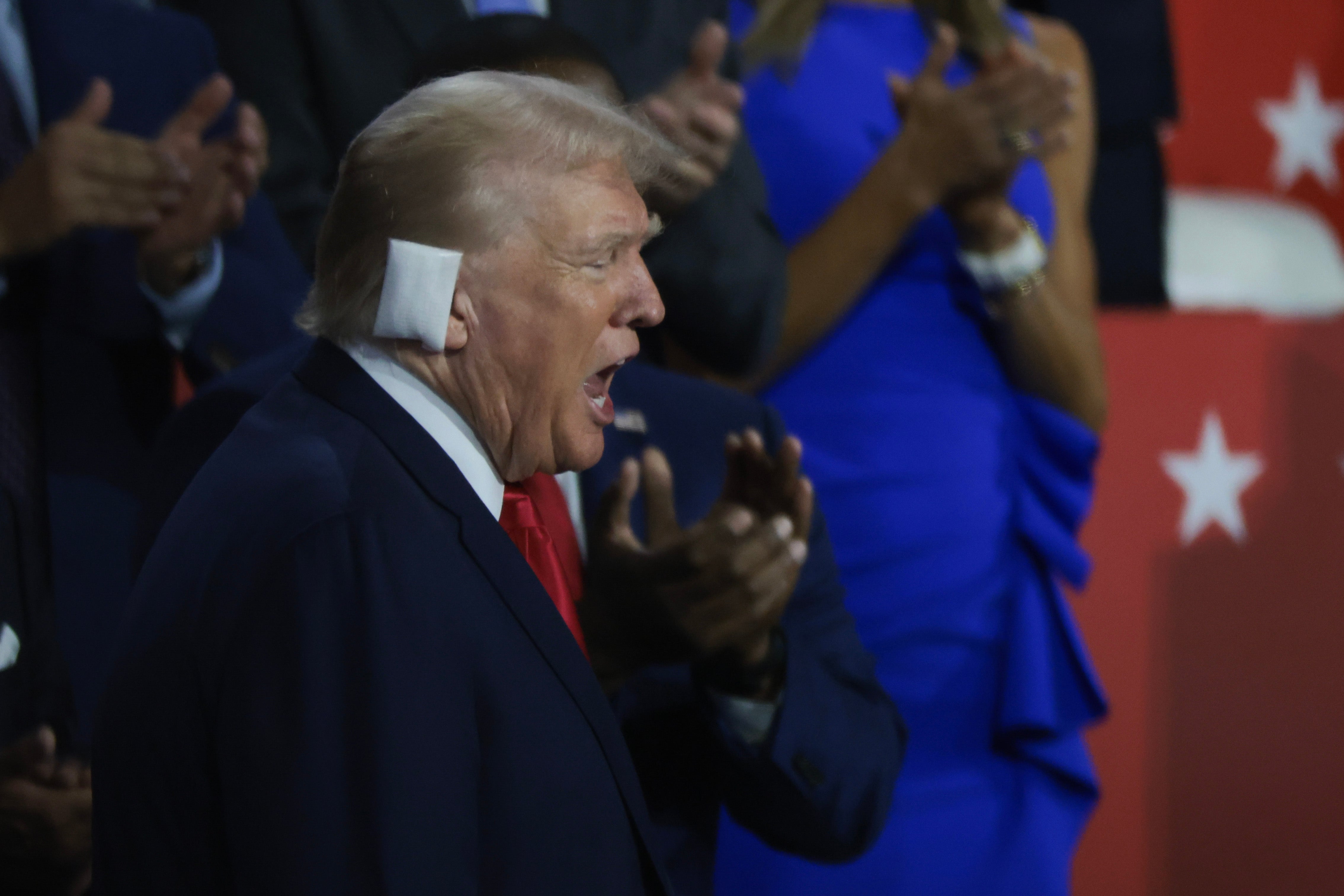 A white bandage covers Donald Trump’s right ear, marking the spot where a bullet fired by a gunman armed with an AR-15 rifle grazed his head on July 13.