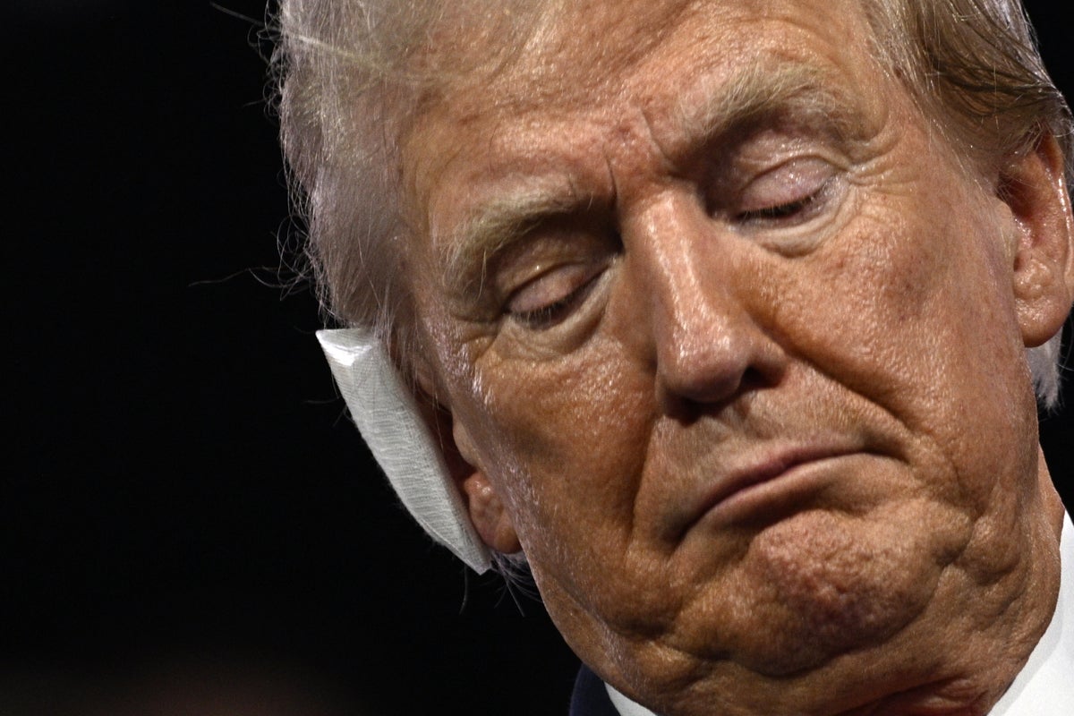 Trump confessed ear injury was ‘not too bad’ at RNC despite wearing oversized bandage, Congressman says
