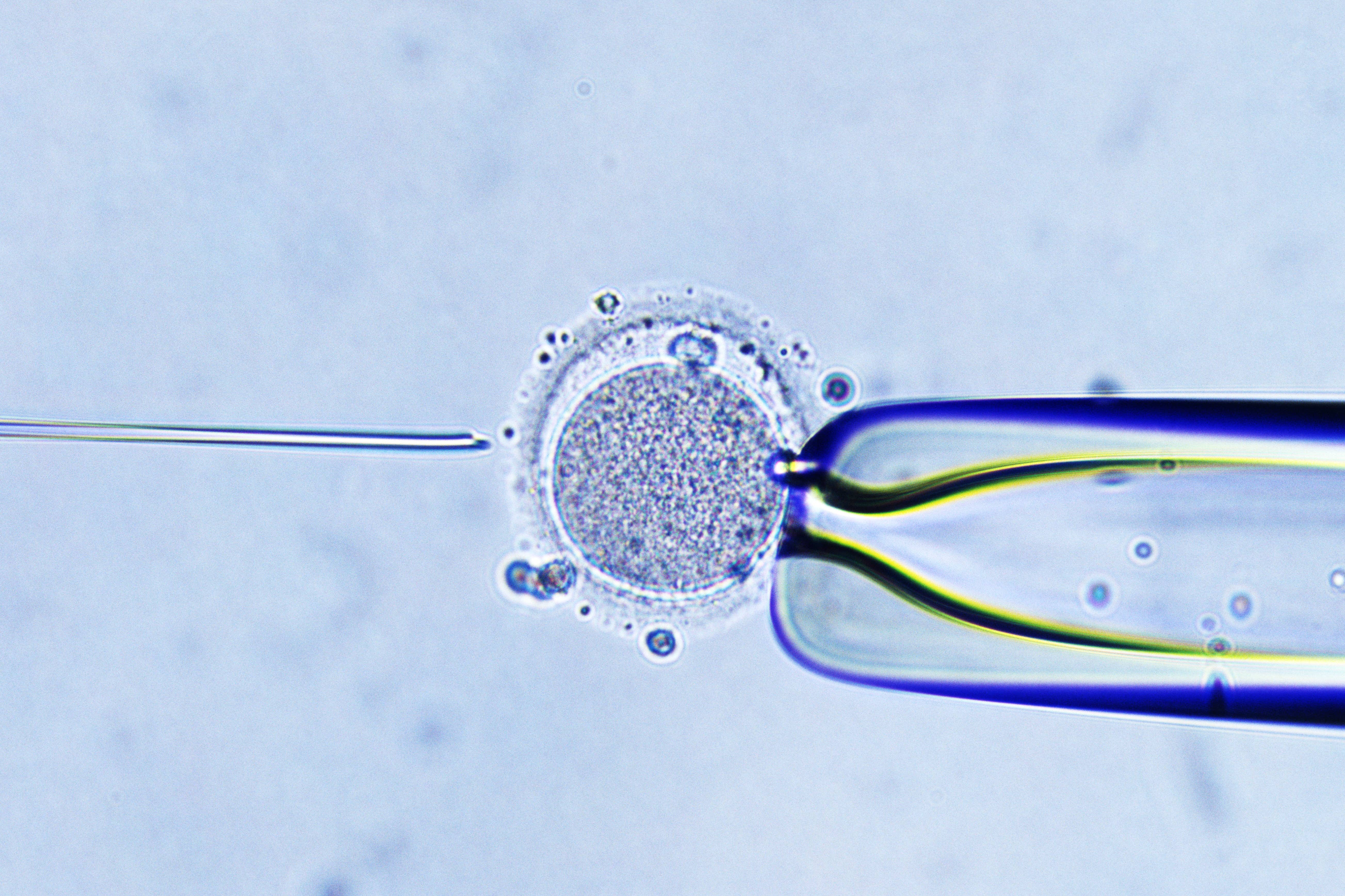 TLI for embryo selection in IVF does not improve the odds of live birth, study shows (Jochen Tack/Alamy Stock Photo)