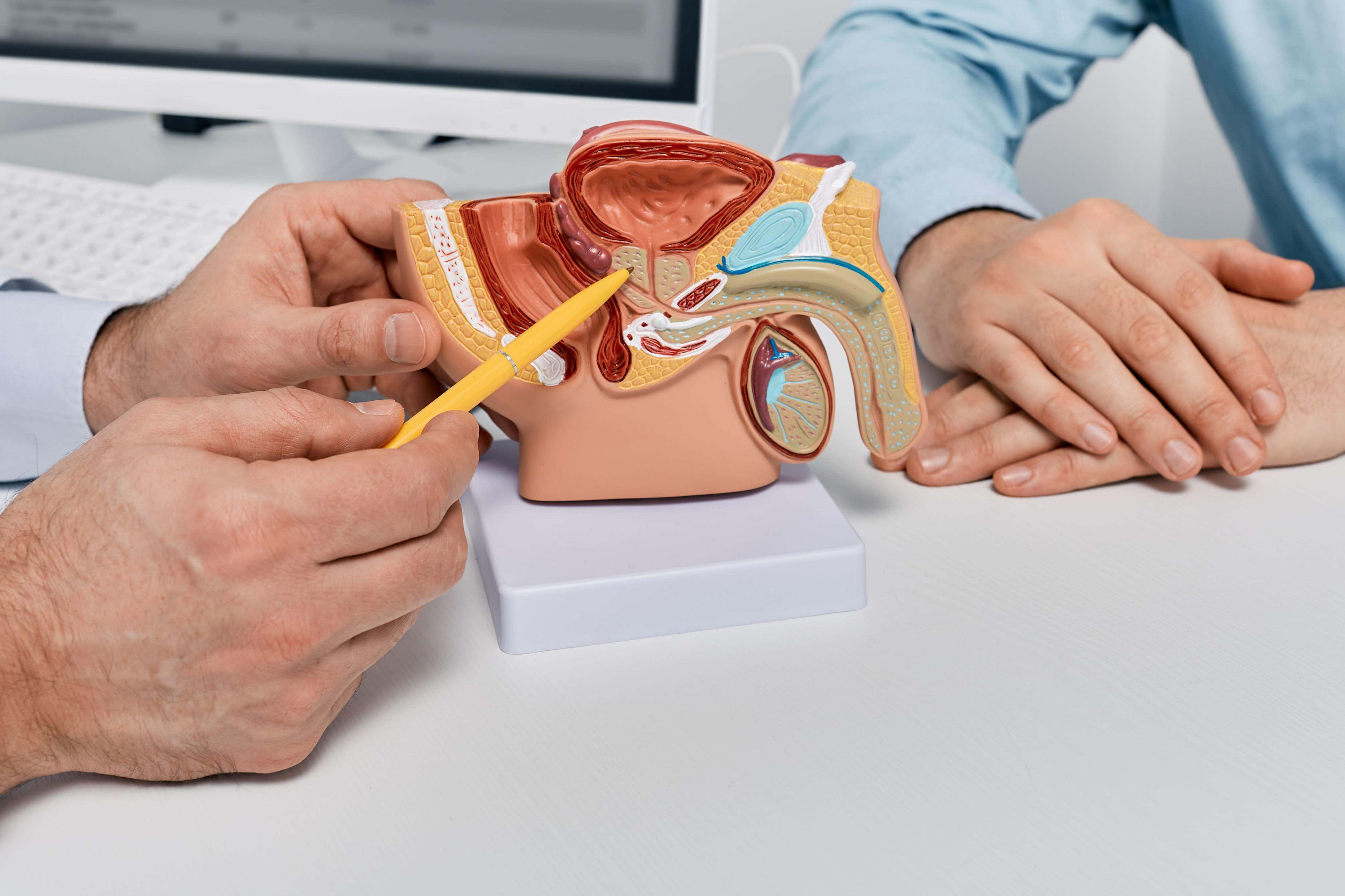 A doctor demonstrating where the prostate is to a patient