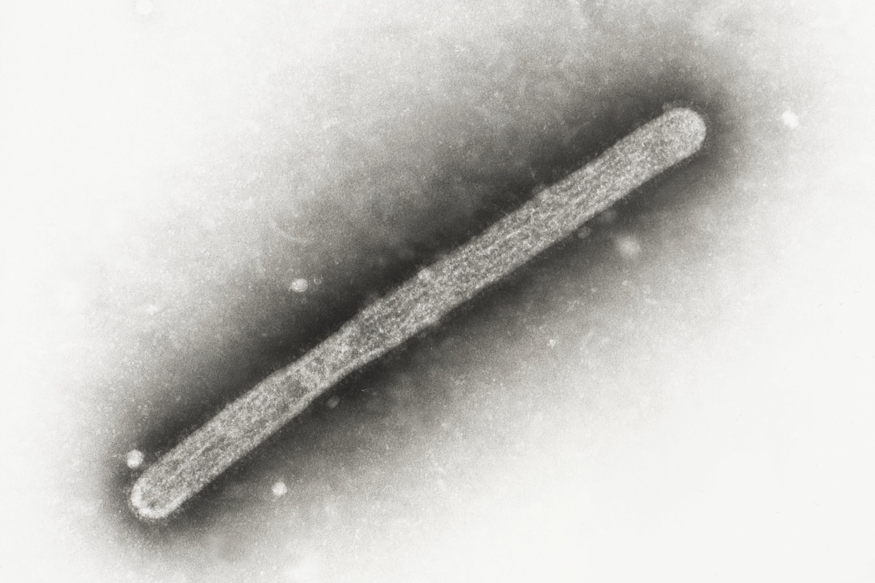 A 2005 electron microscope image shows the avian influenza strain H5N1. Bird flu is widespread in wild birds, and is causing outbreaks in poultry and dairy cows, and people who work around them. However, the CDC says that current public health risk is low.