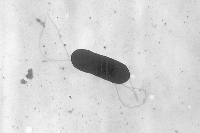 <p>An electron microscope shows a Listeria monocytogenes bacterium. A total of 28 people have fallen ill, and two people have died as a result of a listeria outbreak linked to sliced deli meats </p>