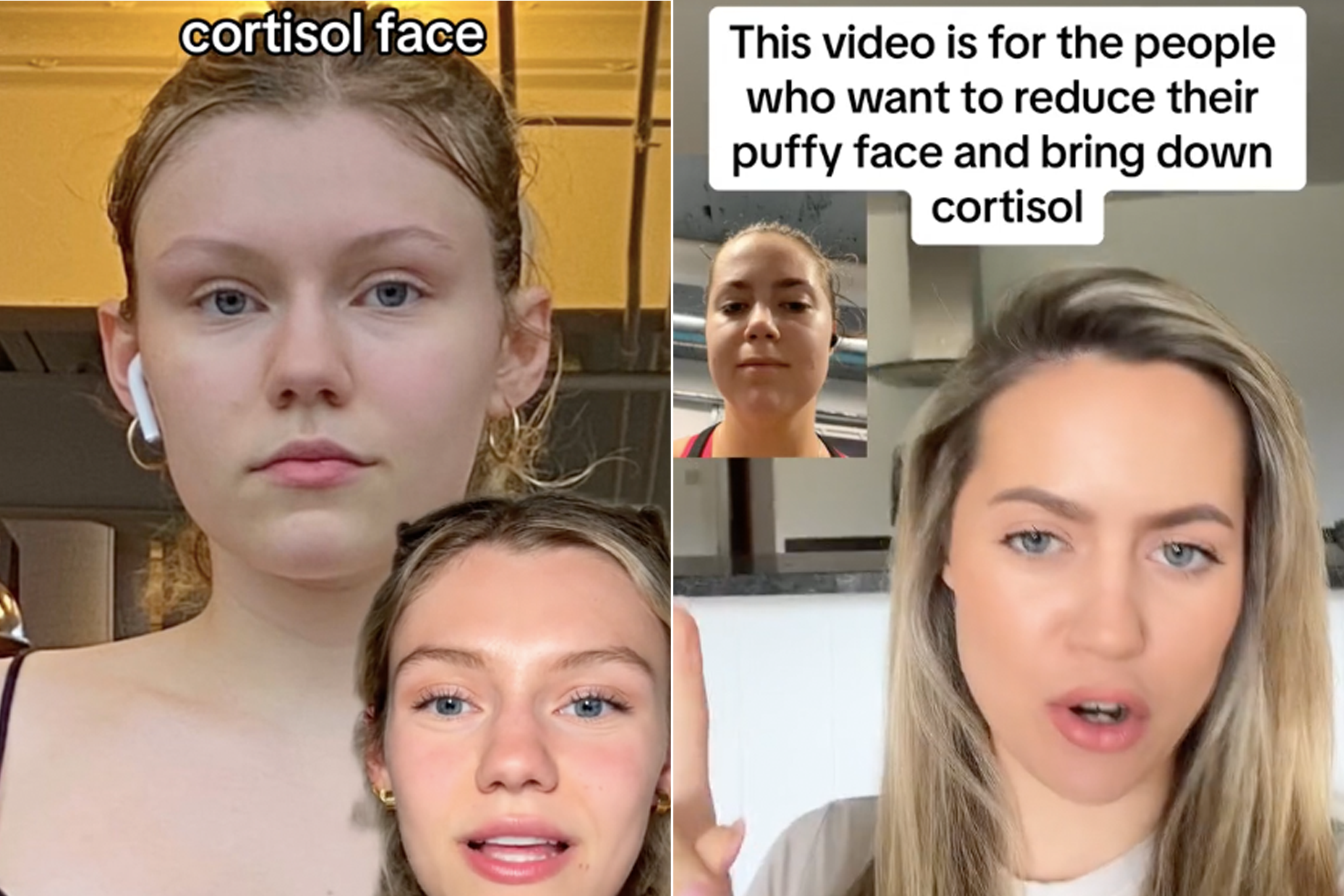 Tik Tok started the Cortisol Face trend