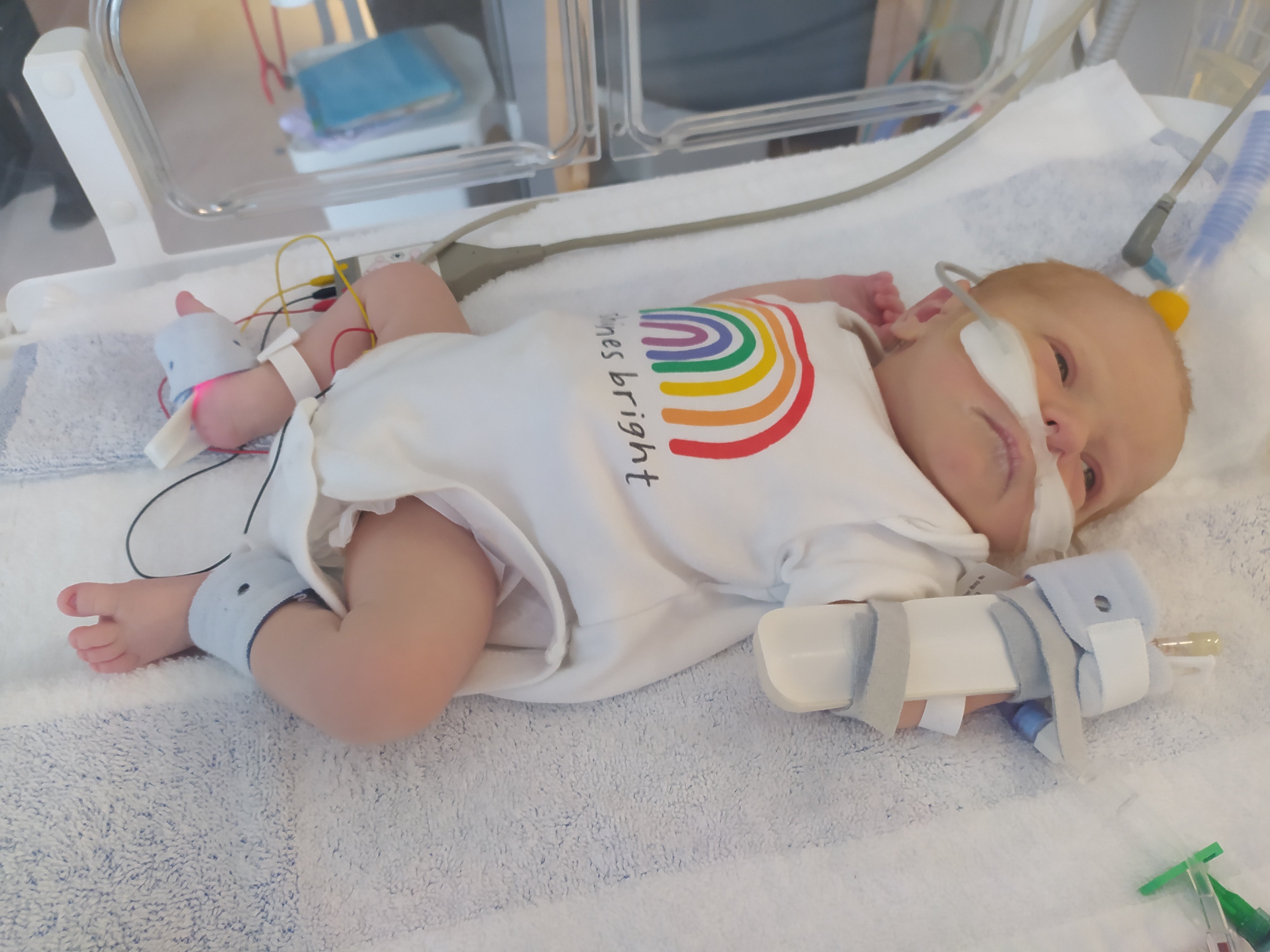 After doctors initially thought Leon had fluid on his lungs and then an unknown infection, he spent seven days in a neonatal intensive care unit