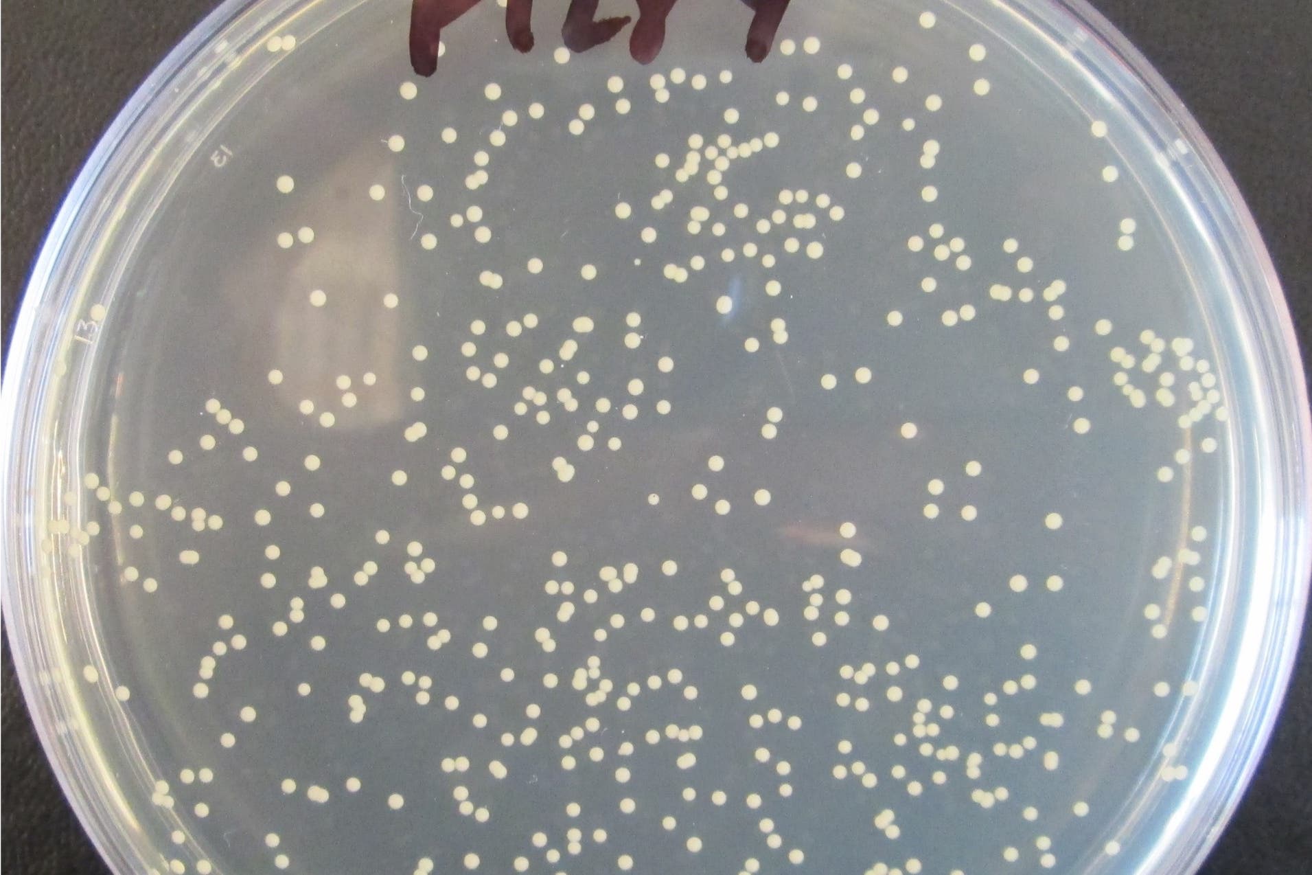 A sample of Sarm bacteria
