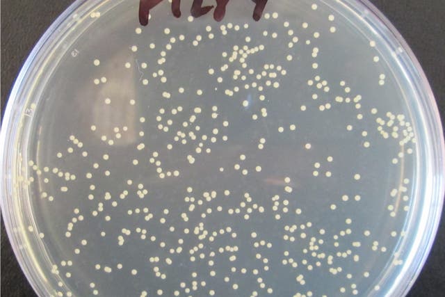 A sample of MRSA bacteria (University of St Andrews/PA)