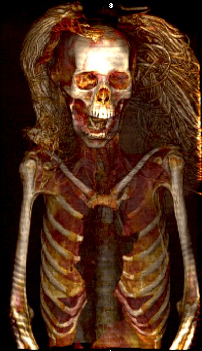 A scanned image of the Sreaming Woman mummy, showing her wig (Sahar Saleem/Cairo University)