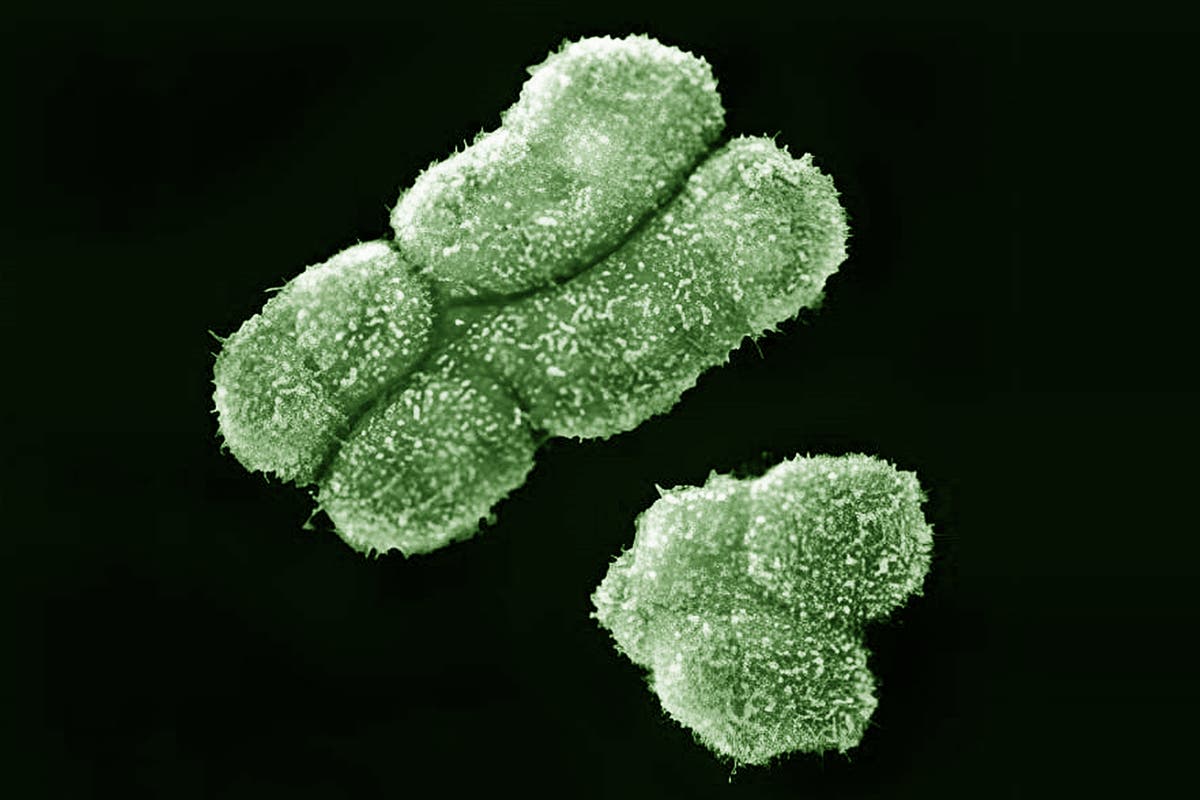 XX and XY chromosome: What are differences in sex development?