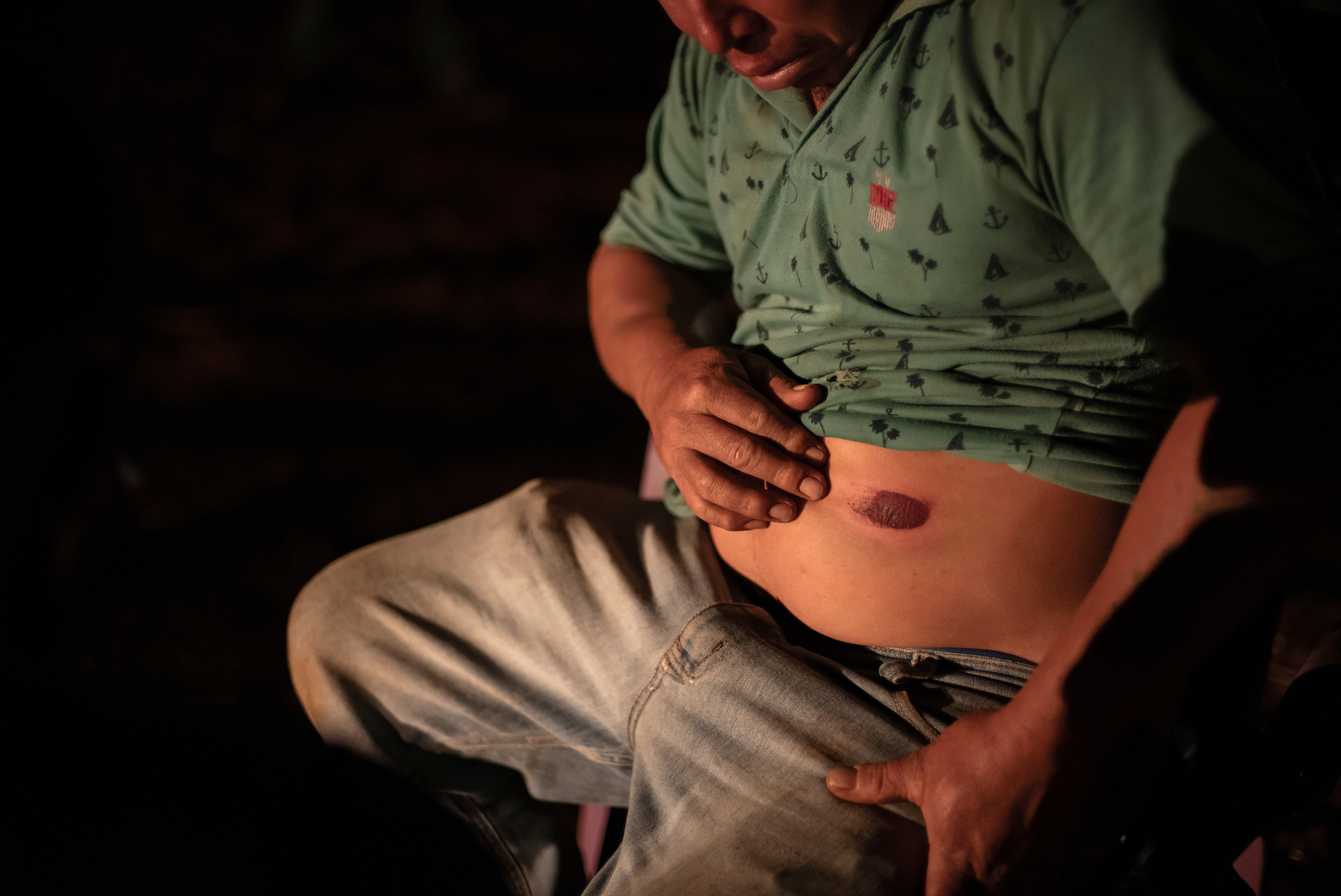 Brazil Indigenous Land Attacks