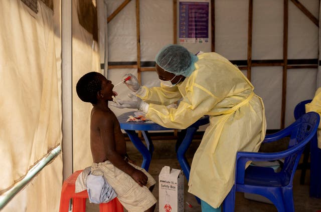 <p>Christian Musema, a laboratory nurse, takes a sample from a child declared a suspected case Mpox - an infectious disease caused by the monkeypox virus that spark-off a painful rash, enlarged lymph nodes and fever; at the the treatment centre in Munigi, following Mpox cases in Nyiragongo territory near Goma, North Kivu province, Democratic Republic of the Congo </p>