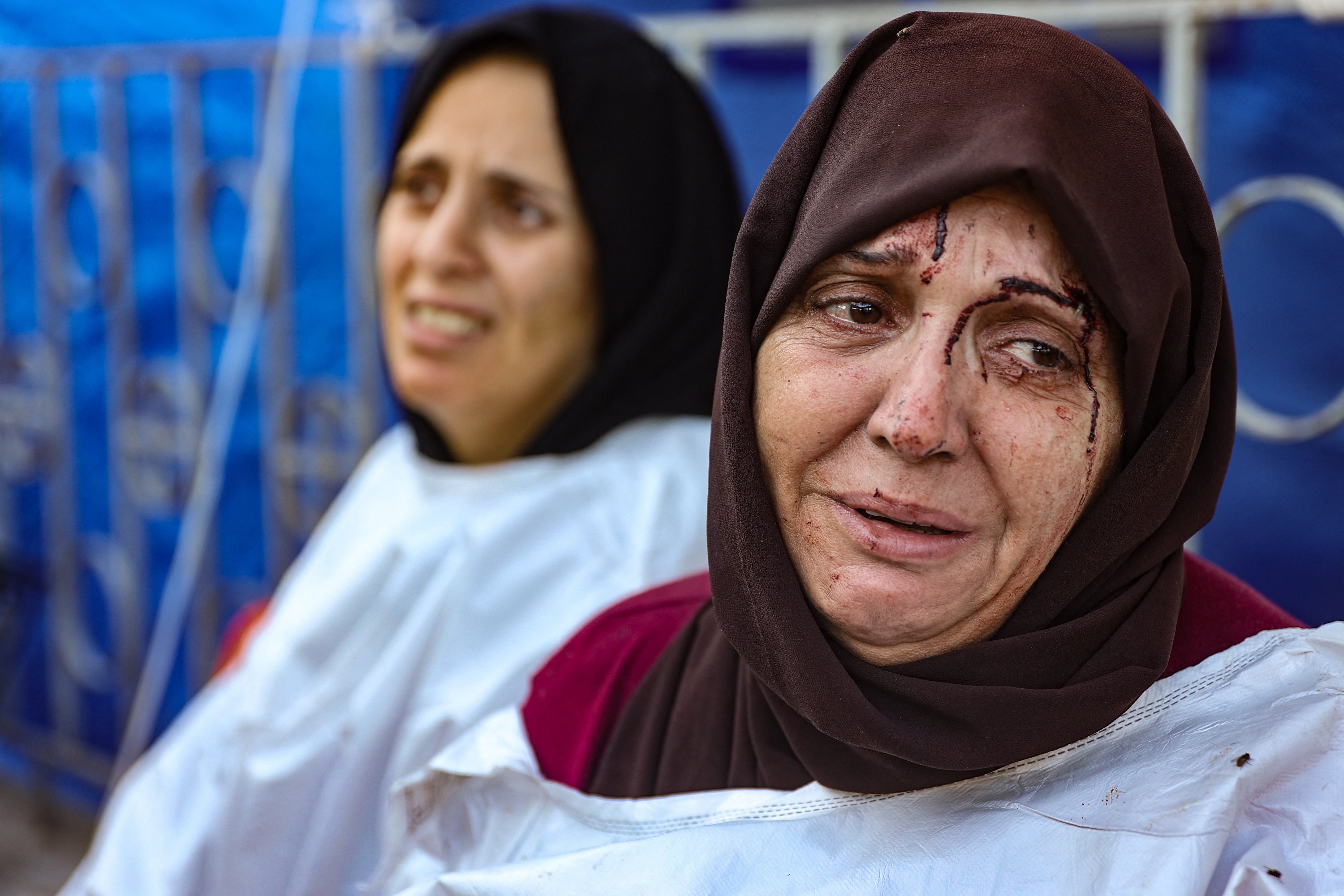 An injured woman reacts after identifying a member of her family among the dead at the al-Maamadani hospital, following an Israeli strike that killed more than 90 people on a school sheltering displaced Palestinians