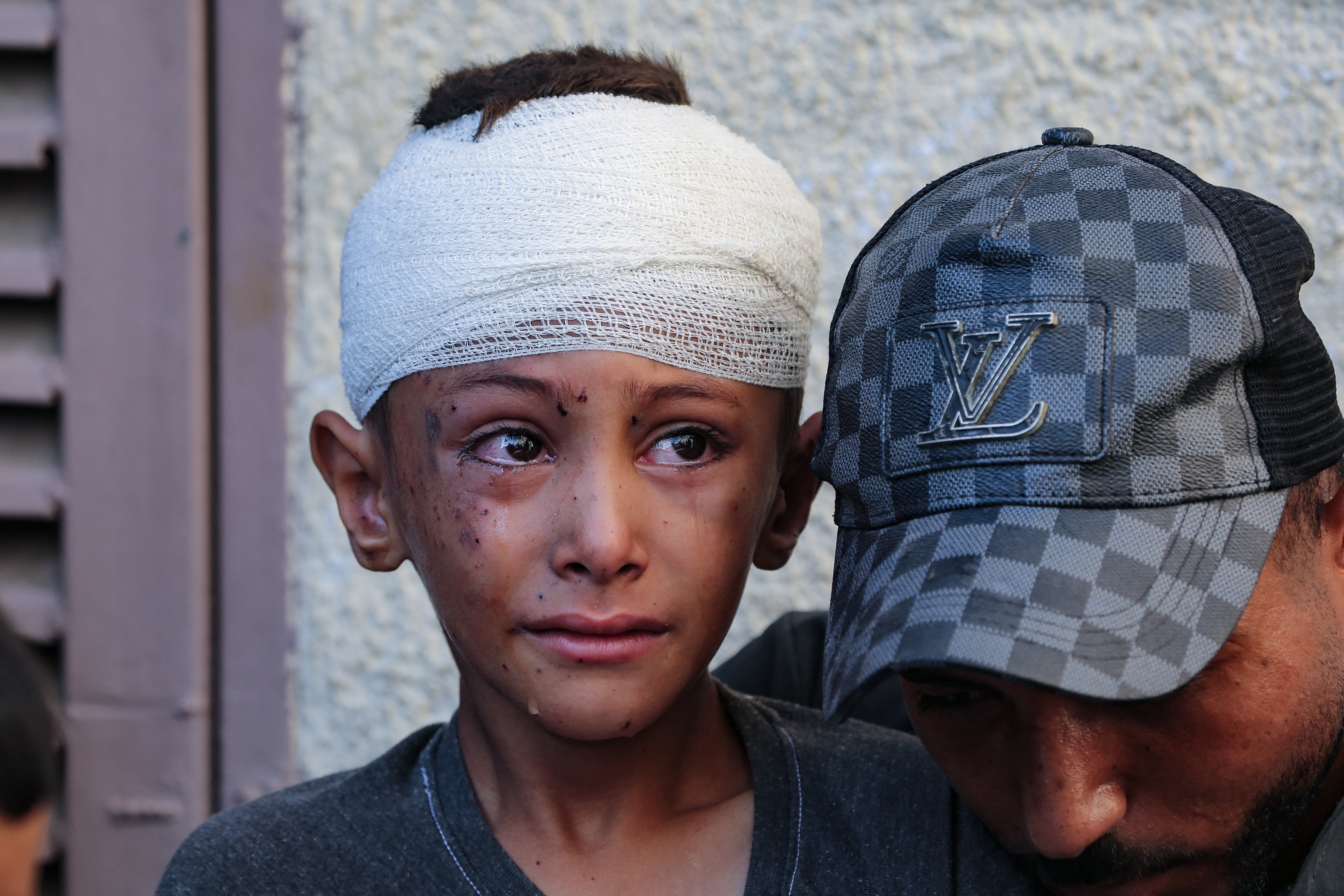 An injured child cries in the yard of the Al-Aqsa Martyrs hospital in Deir el-Balah in the central Gaza Strip, following an overnight Israeli strike