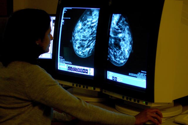 Concerns have been raised about a shortage of mammographers in the NHS in England (Rui Vieira/PA)