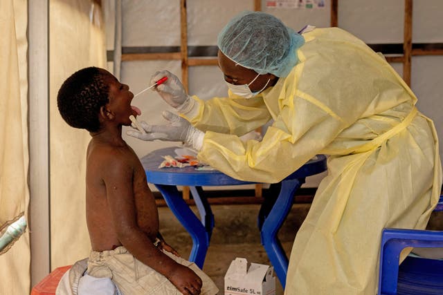 <p>Los niños en los campos de desplazados del Congo corren peligro tras el surgimiento de una nueva variante de viruela símica</p>