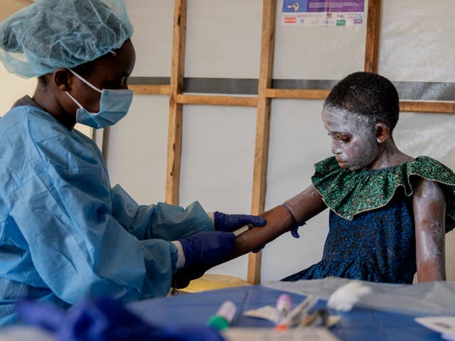 <p>A health worker attends to Lucie Habimana, 13, an mpox patient, at a treatment centre in Munigi, eastern Congo</p>