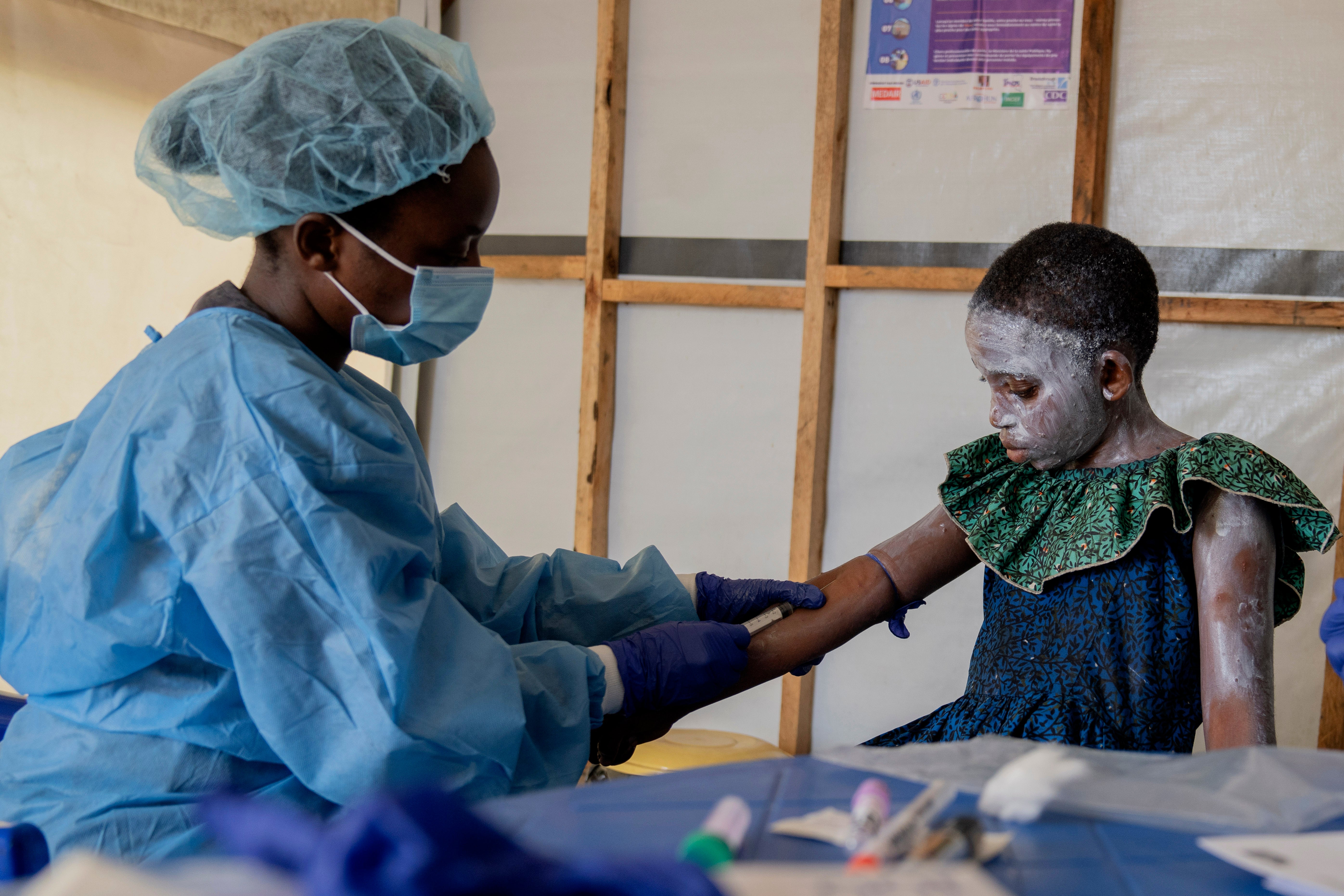 A health worker attends to Lucie Habimana, 13, a mpox patient, at a treatment centre in Munigi, eastern Congo