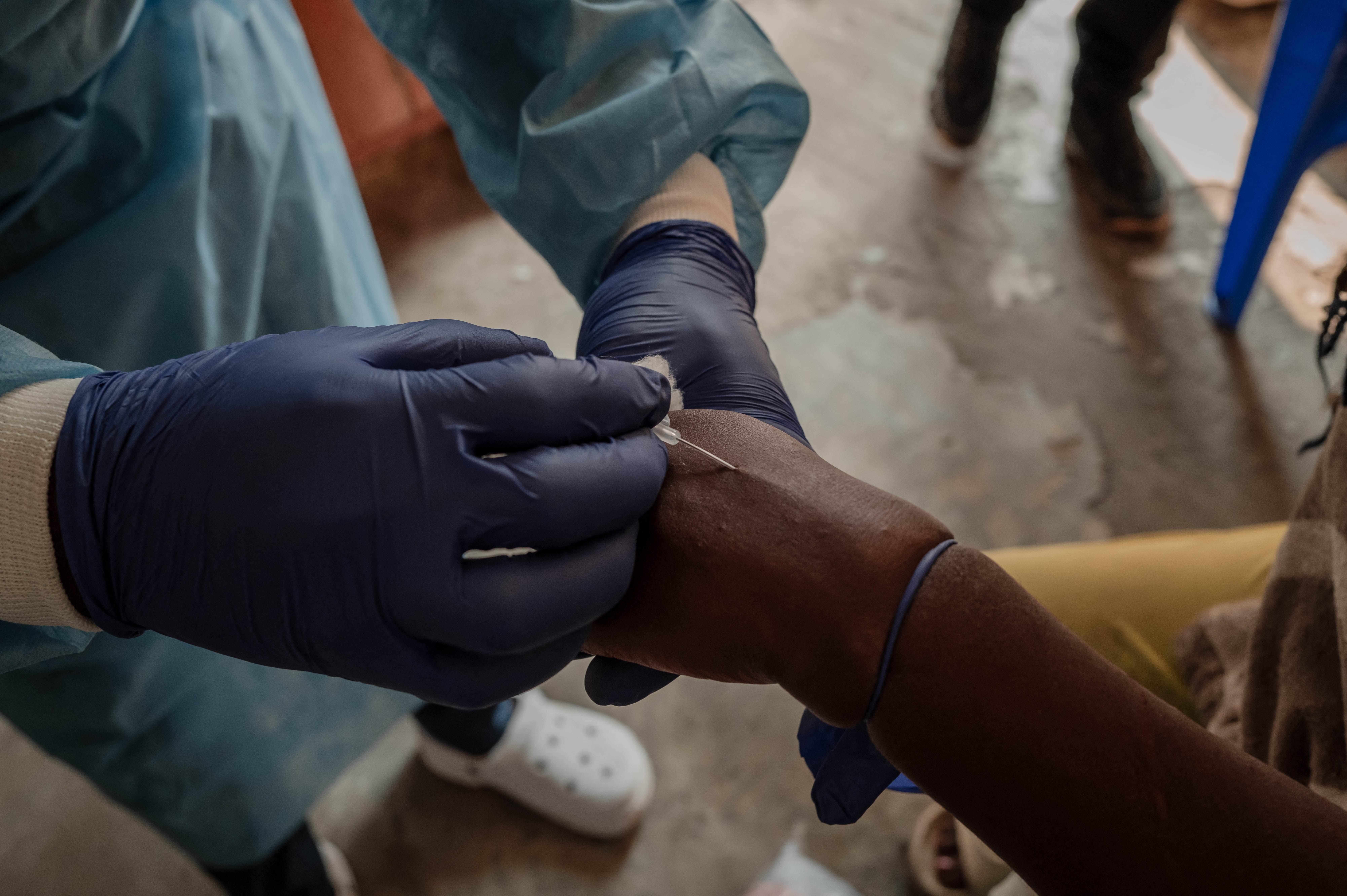 A health worker takes a sample at the Mpox treatment centre of the Nyiragongo general referral hospital, north of the town of Goma in the Democratic Republic of Congo, on August 16, 2024