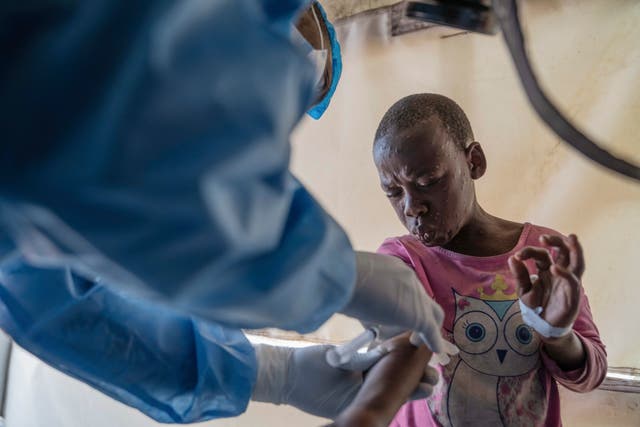 <p>A health worker attends to a mpox patient, at a treatment centre in Munigi, eastern Congo</p>