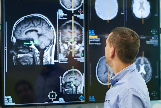 The researchers will analyse thousands of brain scans (Alamy/PA)