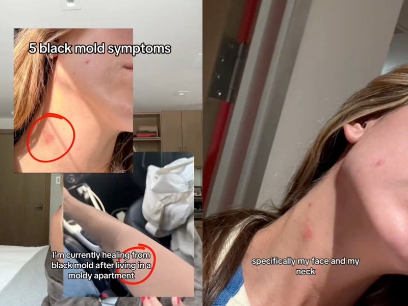 Holistic health coach Autumn Clayman revealed her symptoms on TikTok