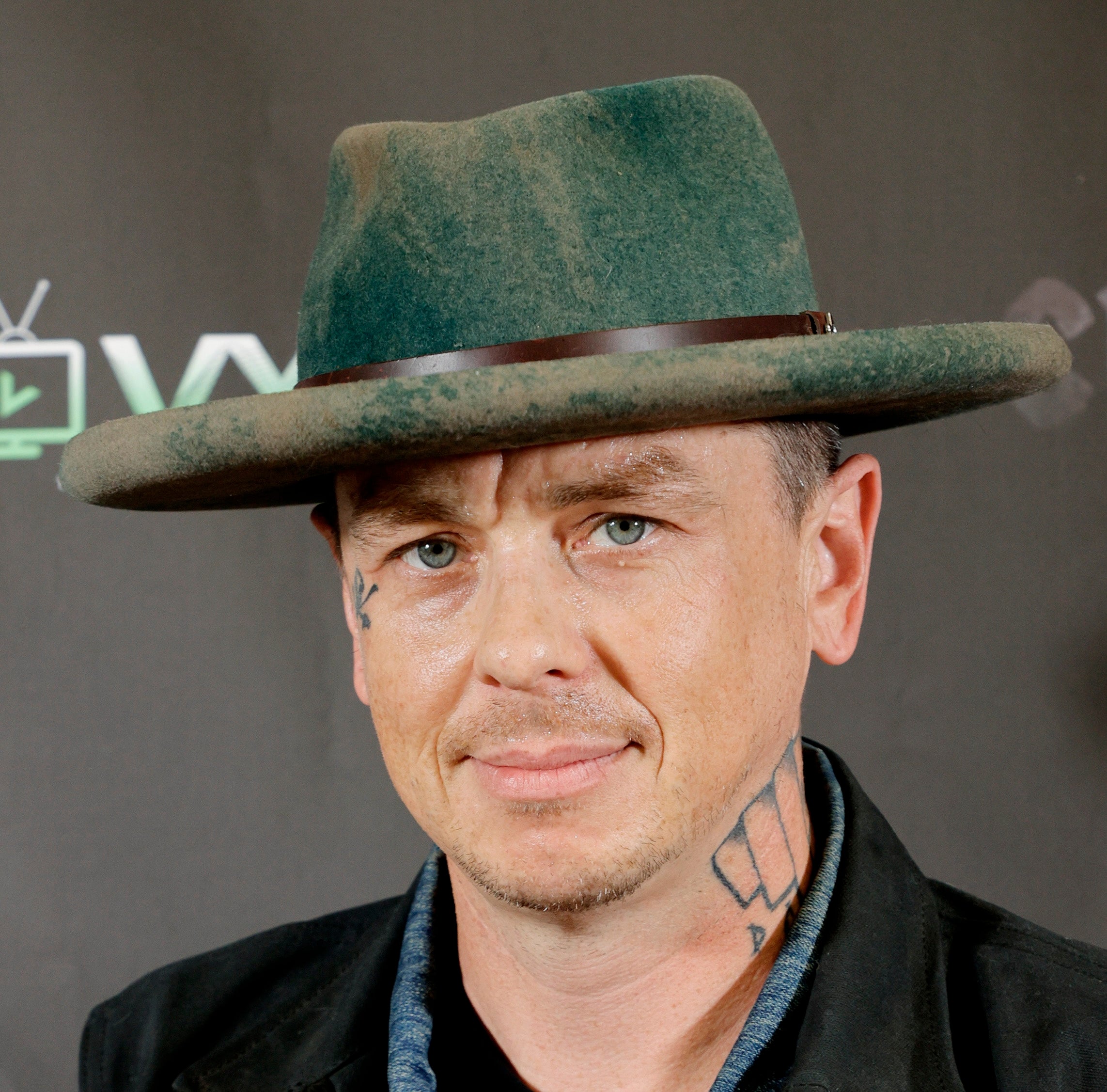 Sid Wilson said he’s lucky to be alive after sustaining serious burns in a bonfire explosion