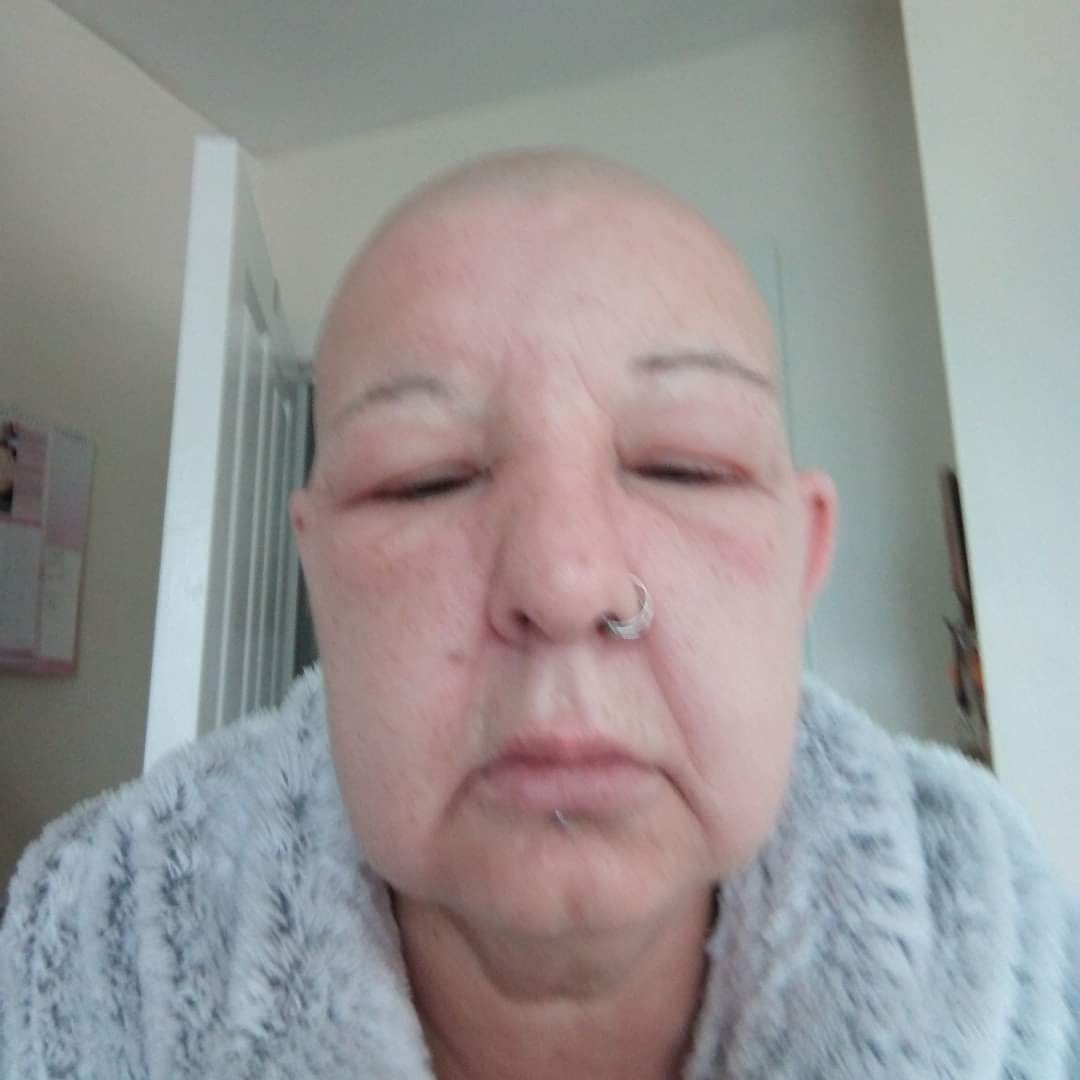 Tammy while she was undergoing treatment