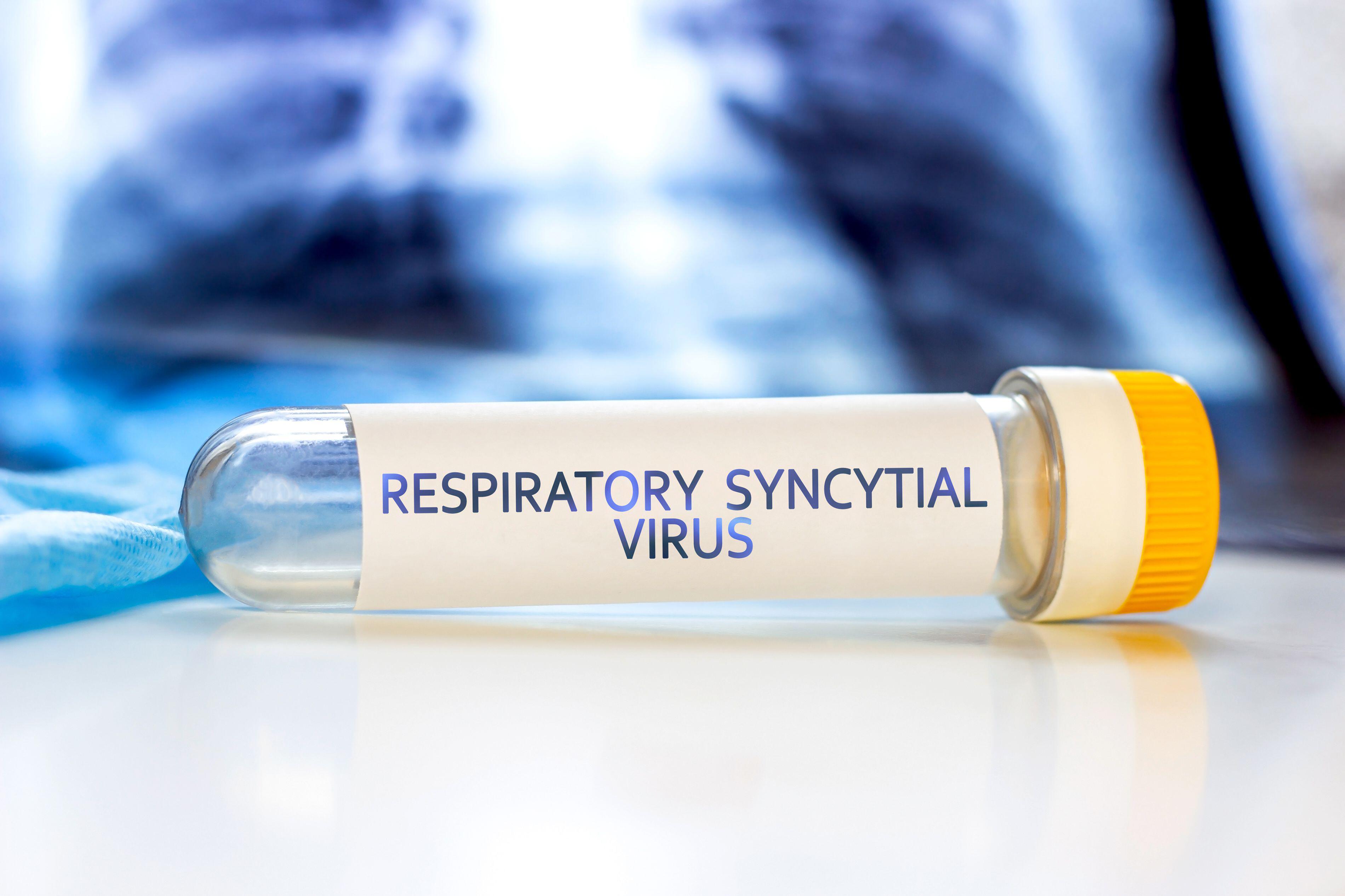 An empty test tube with a label that says 'Respiratory syncytial virus'