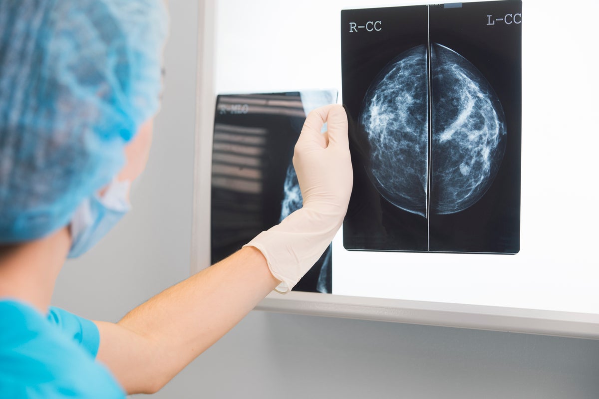 Breast cancer discovery could make treatment more effective