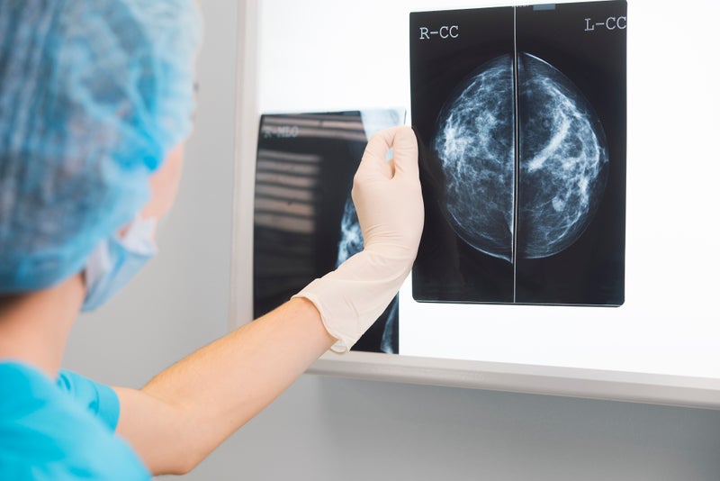 Wes Streeting announces landmark trial to harness AI to speed up breast cancer screening