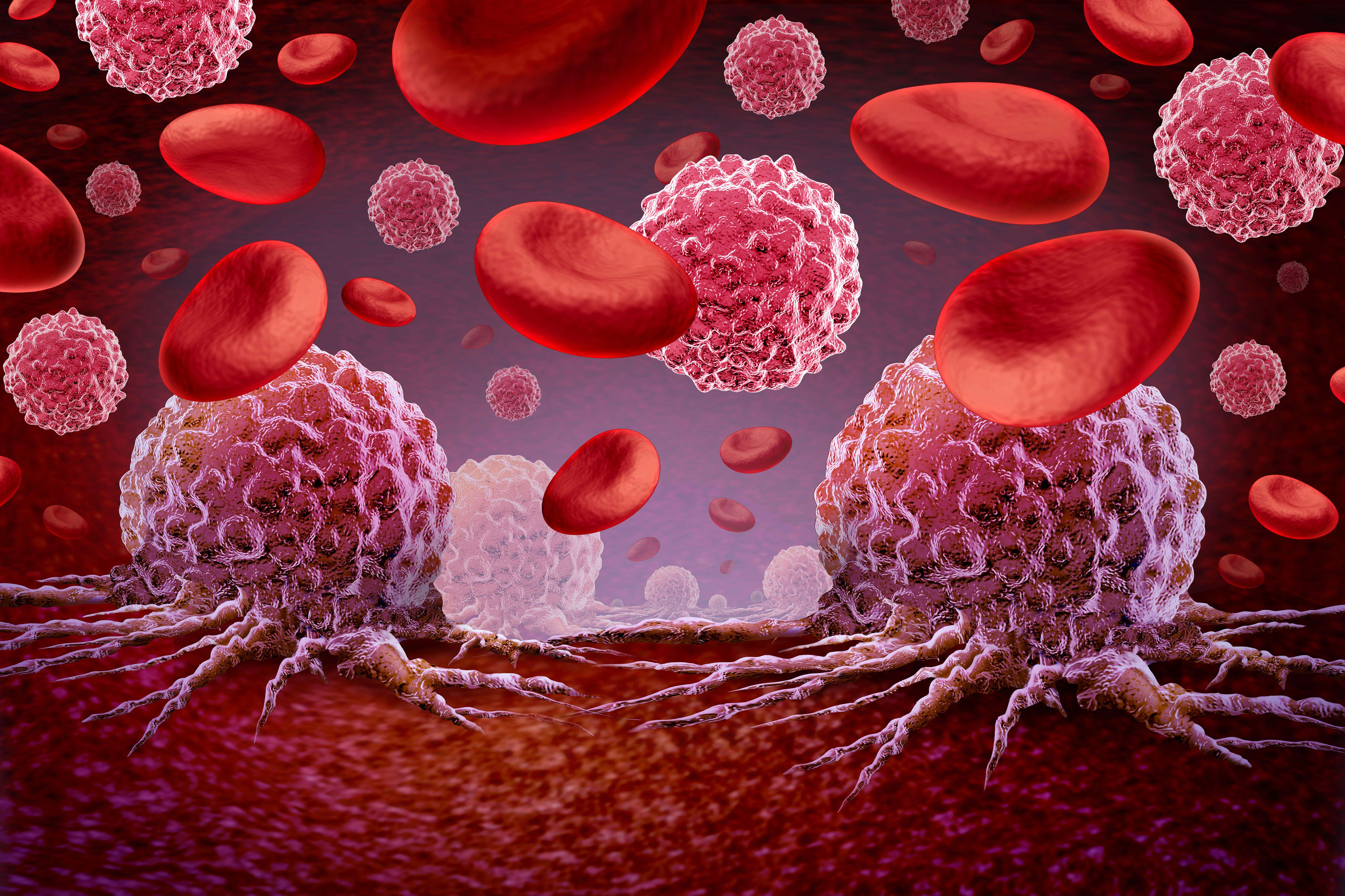 A diagram of cancer cells entering the blood stream