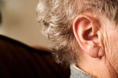 People with sudden hearing loss ‘need steroids within seven days’