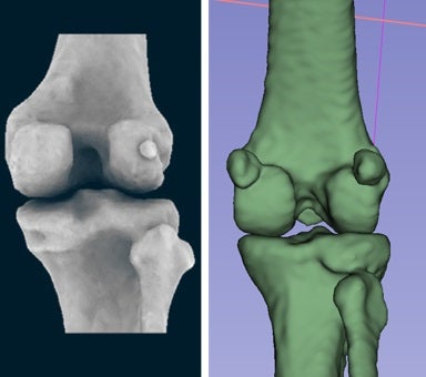 Comparación de la parte posterior de la rodilla de un humano (izquierda) y de un macaco, que muestra la fabela medial y lateral en el macaco y la fabela lateral de un humano.