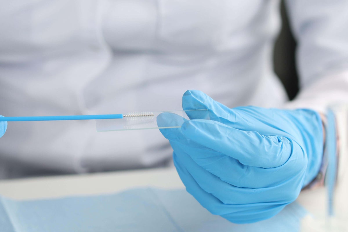 What we know about the new NHS cervical screening guidelines