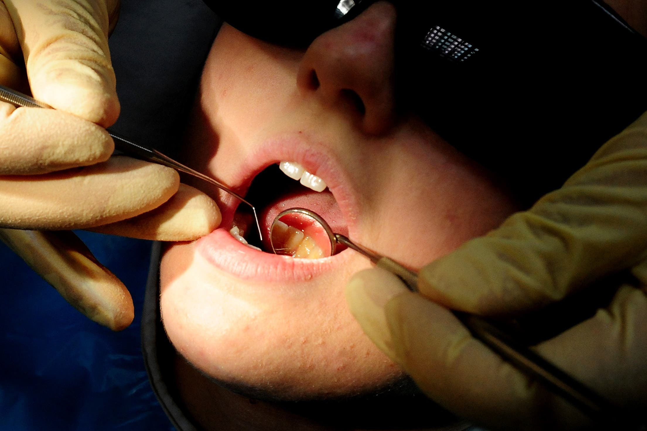 Lib Dems called for an emergency dental registration scheme for children (Rui Vieira/PA)