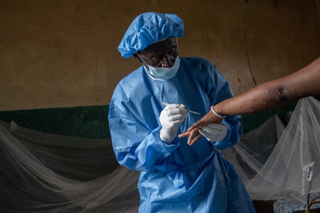 Congo Mpox Outbreak Epicenter
