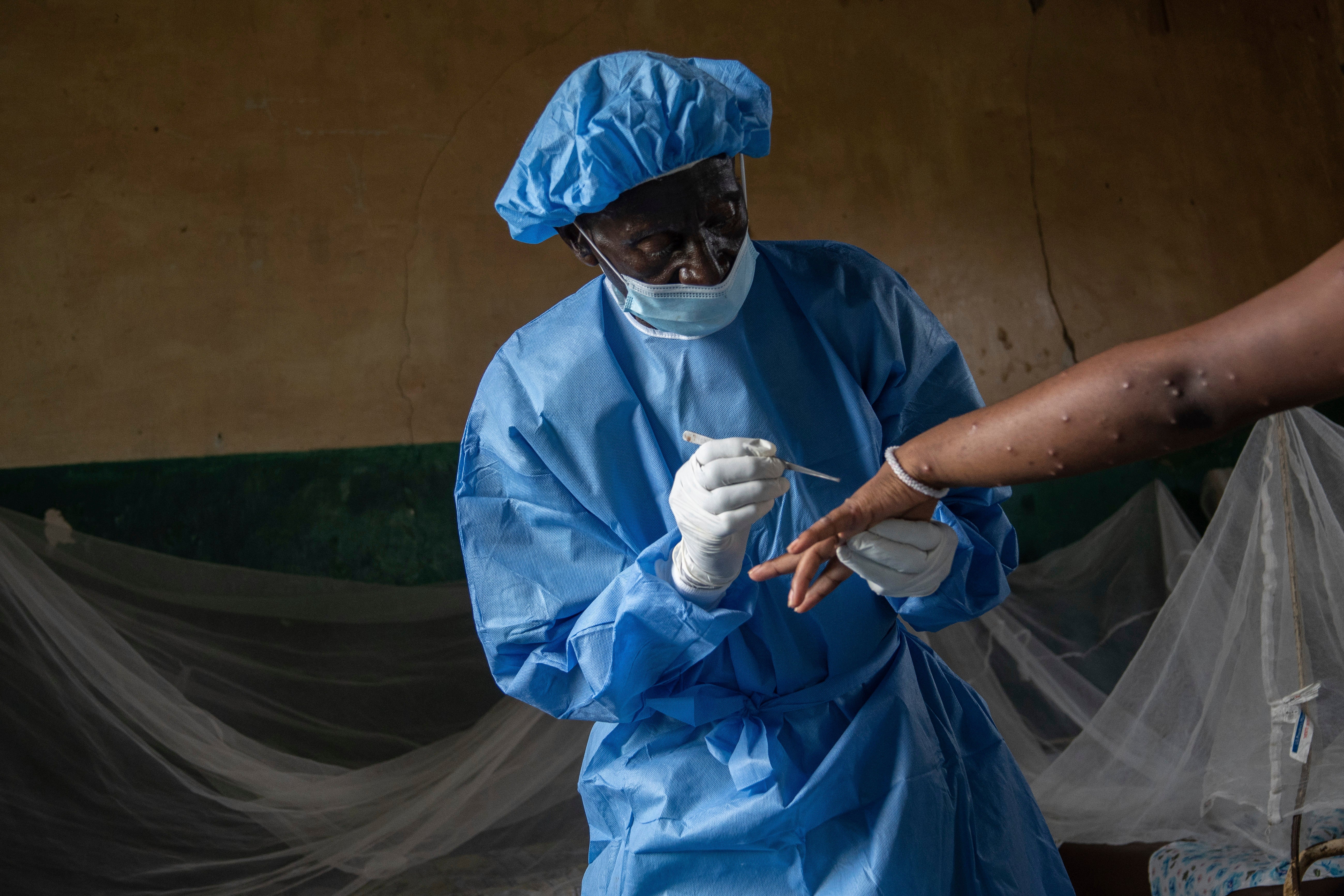 Eastern Congo's South Kivu state  has emerged arsenic  the epicenter of the world's latest outbreak of the disease