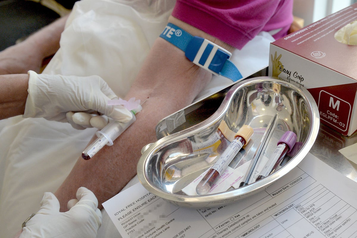 Proof-of-Concept ME/CFS Blood Test Shows 96% Accuracy