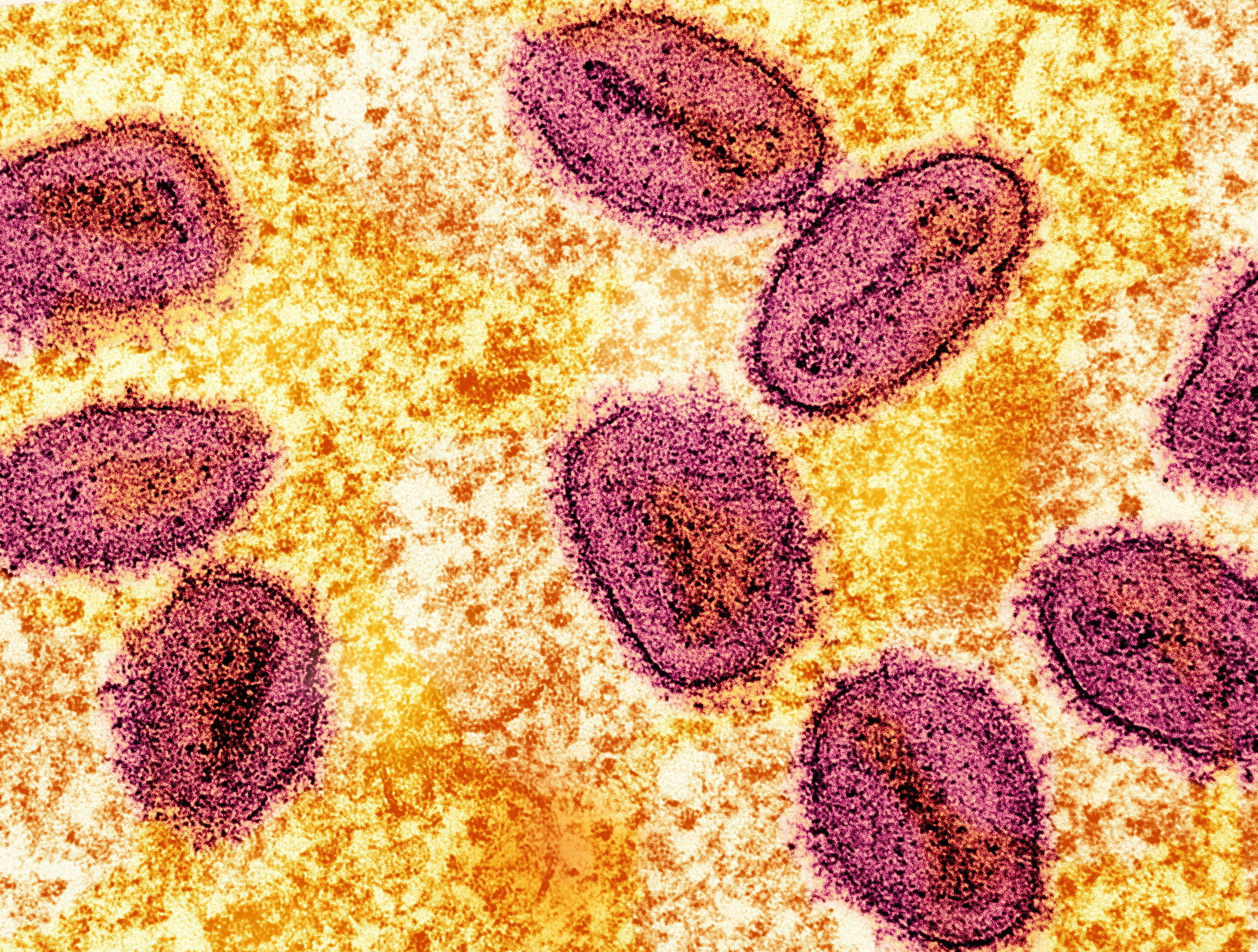  Colorized transmission electron micrograph of mpox microorganism  particles captured astatine  the NIAID Integrated Research Facility successful  Fort Detrick