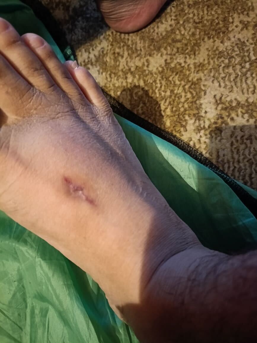 Azad, a Kashmiri resident, says he accidentally shot himself in the foot during training