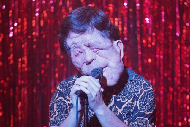 <p>Adam Pearson in ‘A Different Man’ </p>