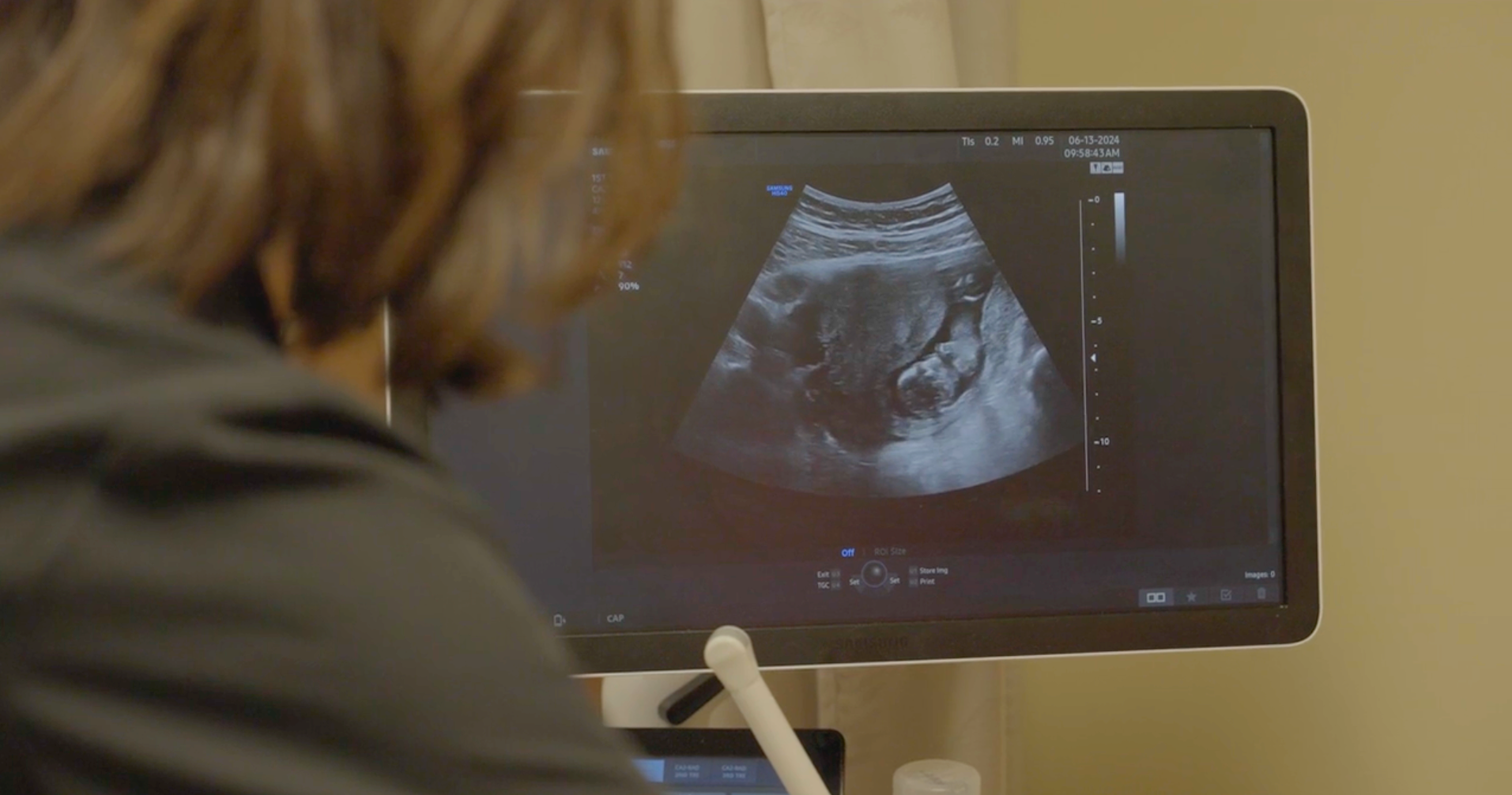 A Tennesse doctor conducts an ultrasound on a pregnant patient